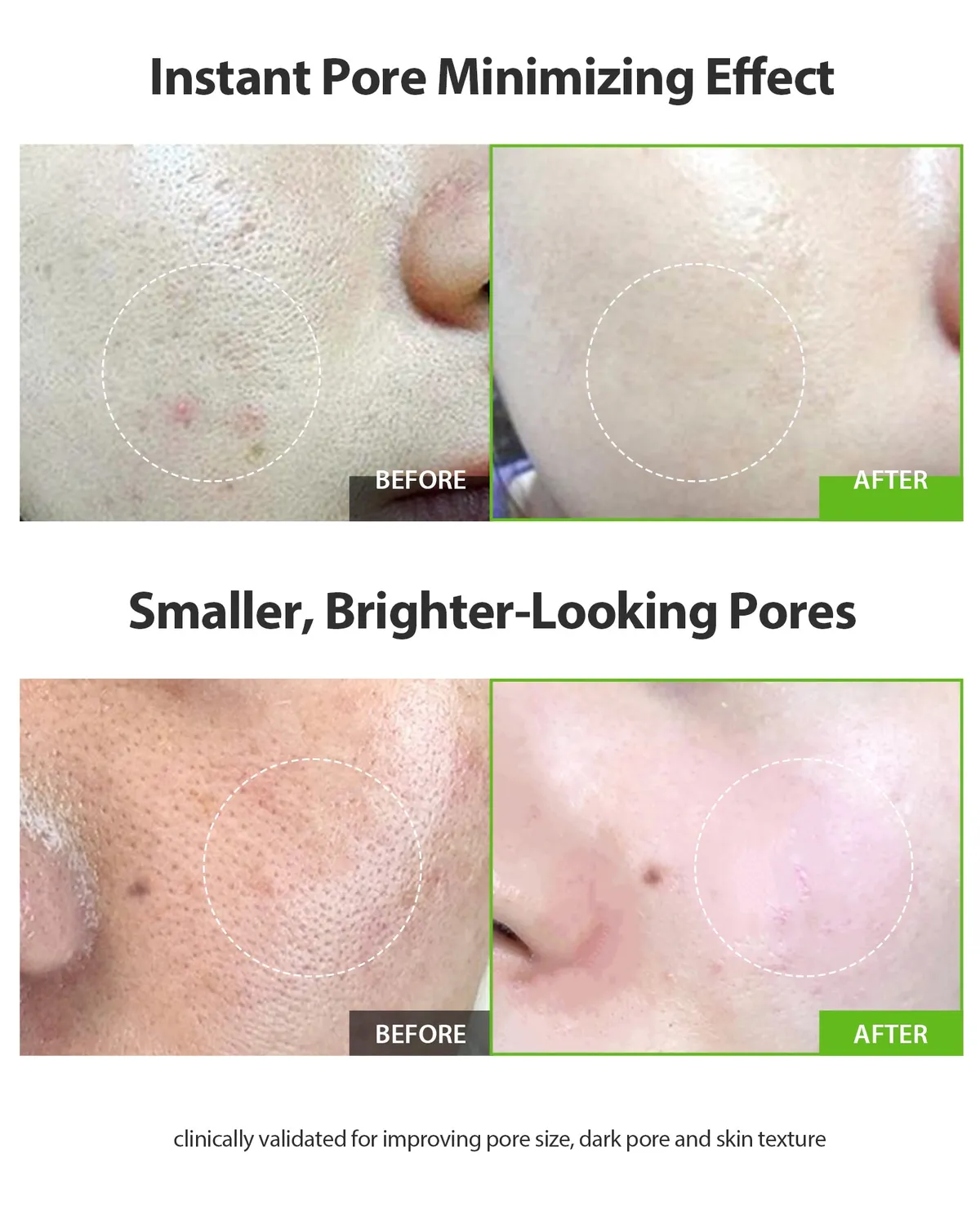 Sungboon Editor Green Tomato Pore Lifting Ampoule 30 ml pori