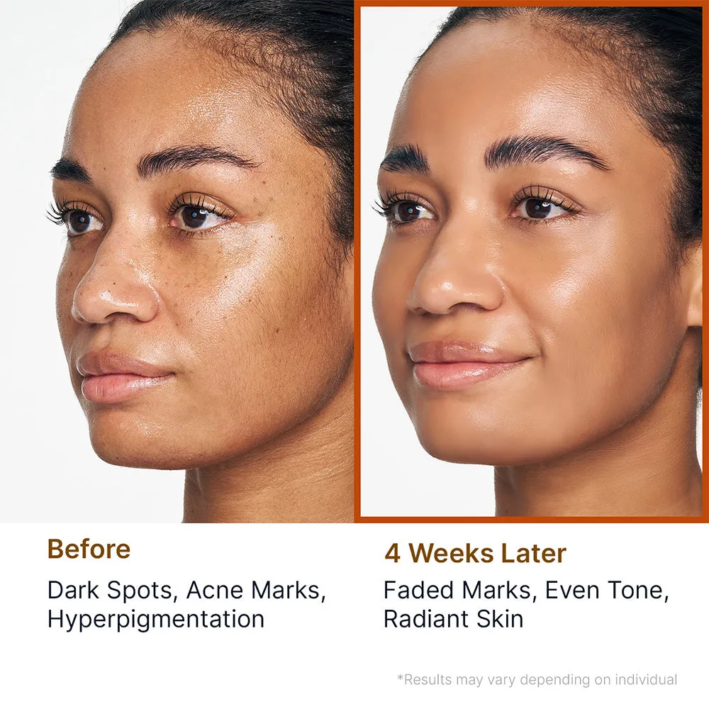 Sungboon Editor Kojic Acid Cleansing Duo viso macchie scure