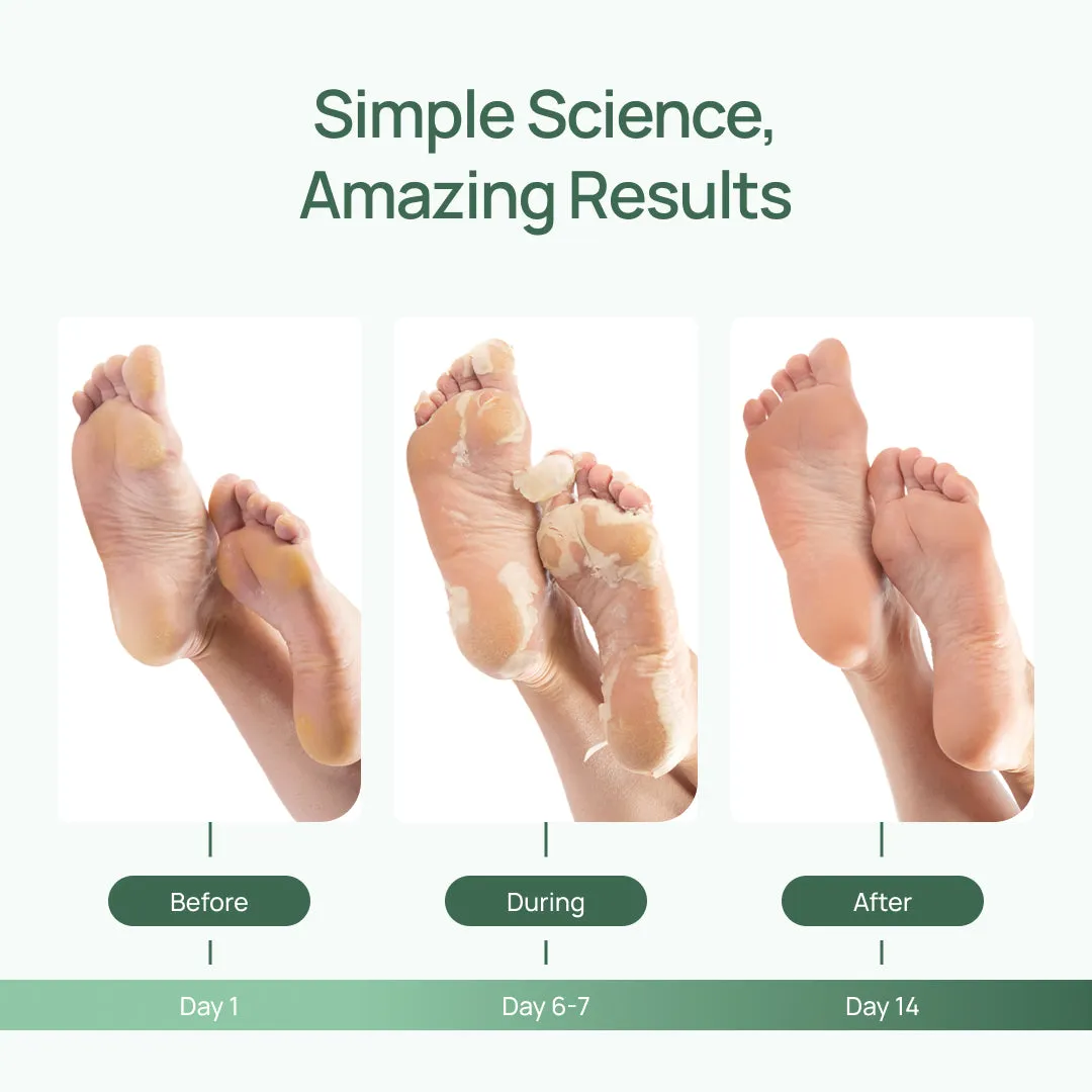 Plantifique Baby Soft Feet combo maschere piedi peeling+idratante
