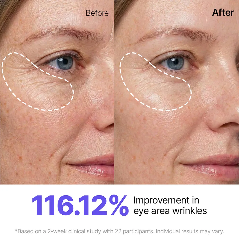 Sungboon Editor Peptide Lifting routine viso 5 step rassodante