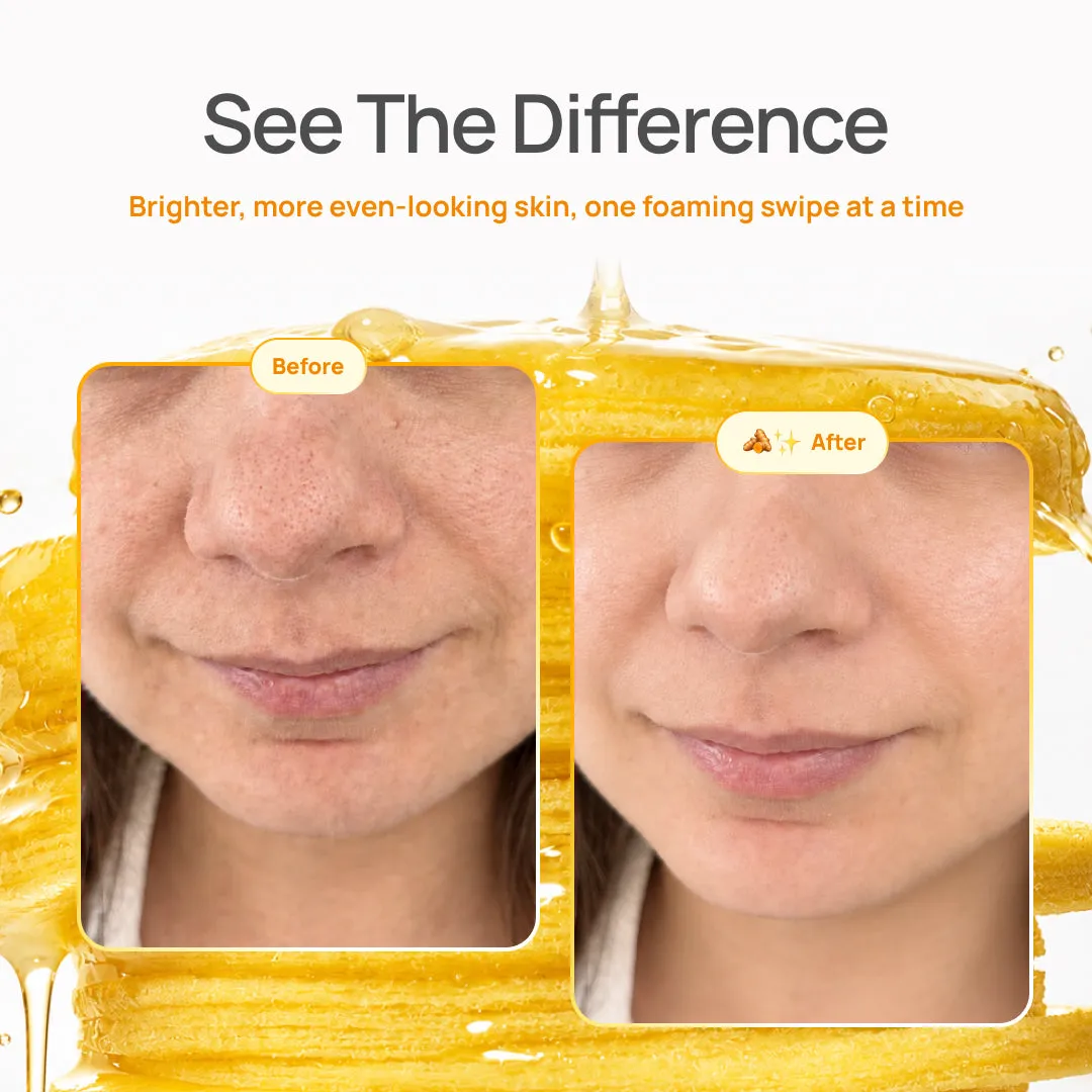 Plantifique Kojic Acid Turmeric dischetti viso schiarenti