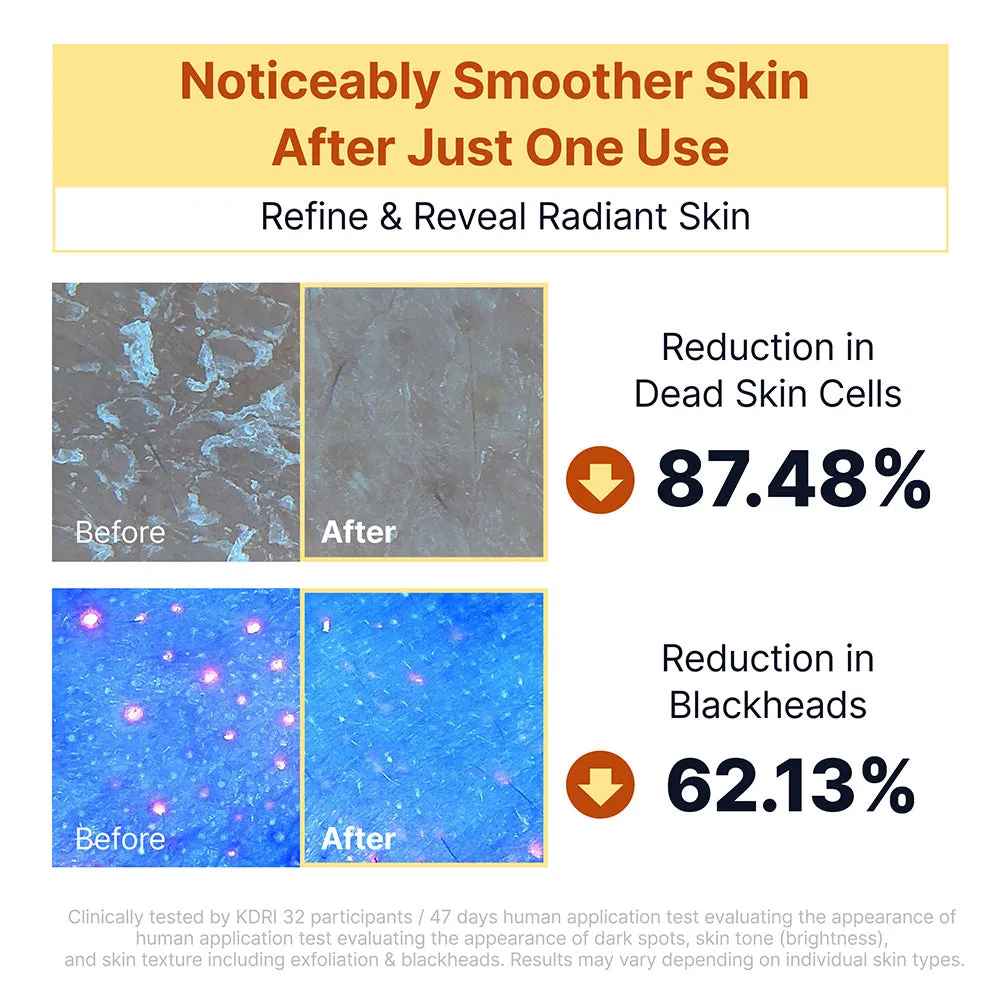 Sungboon Editor Kojic Acid Rice Peel Shot 80 ml esfoliante