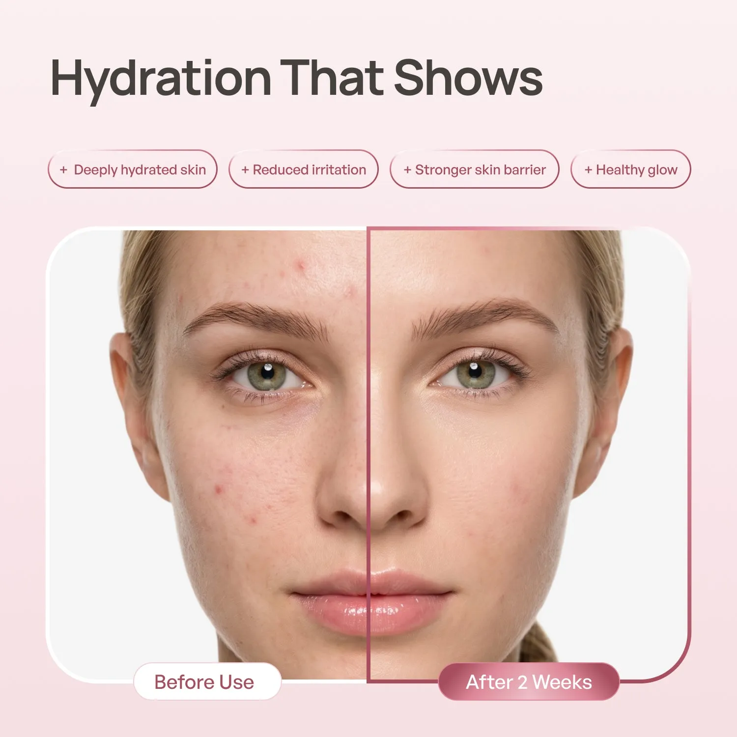 Plantifique PDRN Milky Rice tonico viso barriera idratata