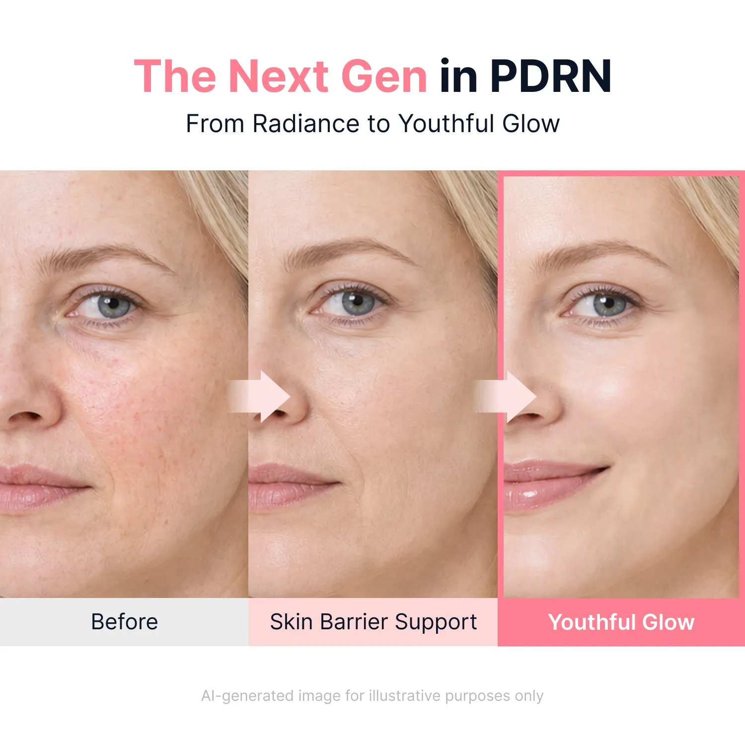 Sungboon Editor PDRN Pink Vitamin Crema Toy Story 5 glow