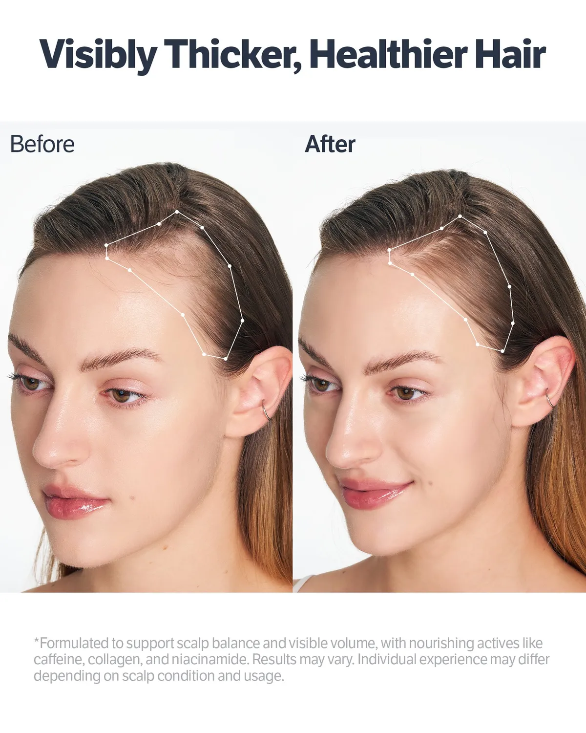 Sungboon Editor Deep Collagen Retinol siero cuoio capelluto 15 ml rinforzante