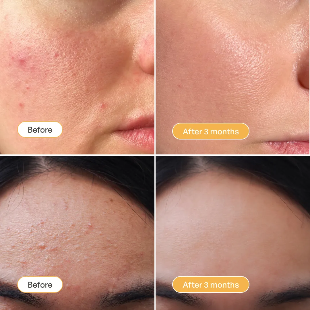 Plantifique Turmeric Vitamin C maschera viso argilla illuminante