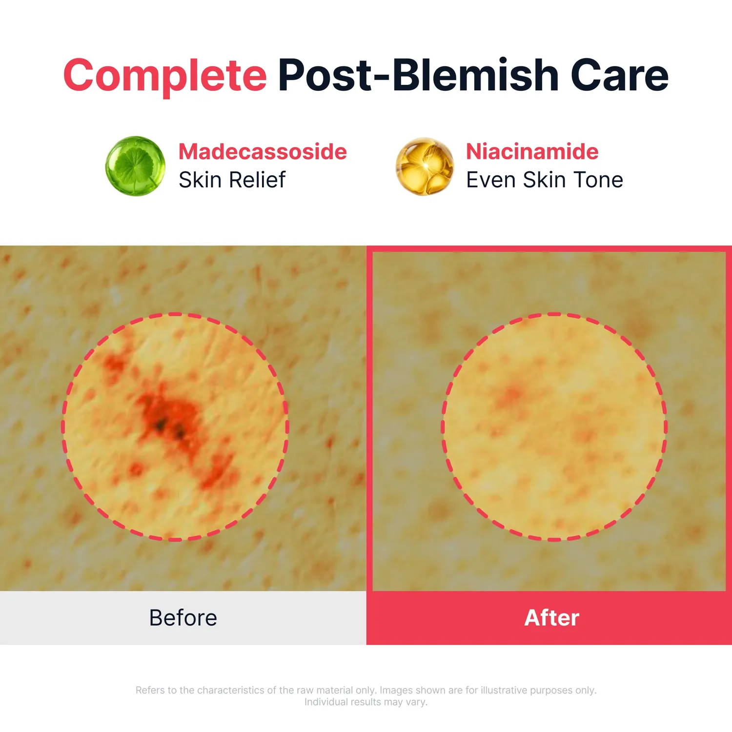 Sungboon Editor Red Heartleaf BHA-Lino Relief Ampoule viso