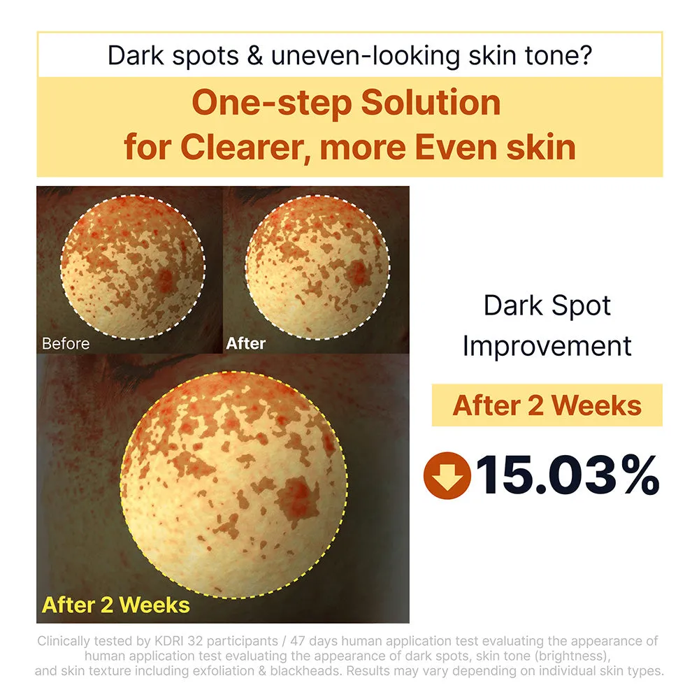 Sungboon Editor Kojic Acid Rice Peel Shot 80 ml esfoliante
