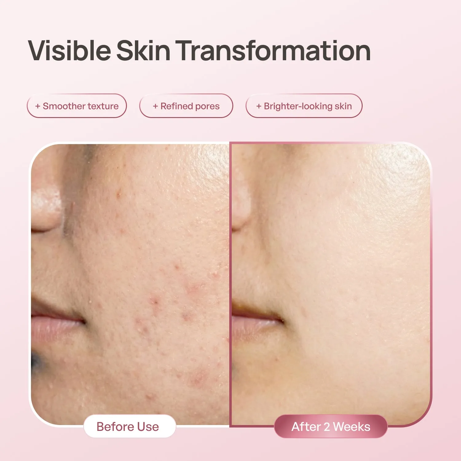 Plantifique PDRN Niacinamide 10% siero viso macchie pori