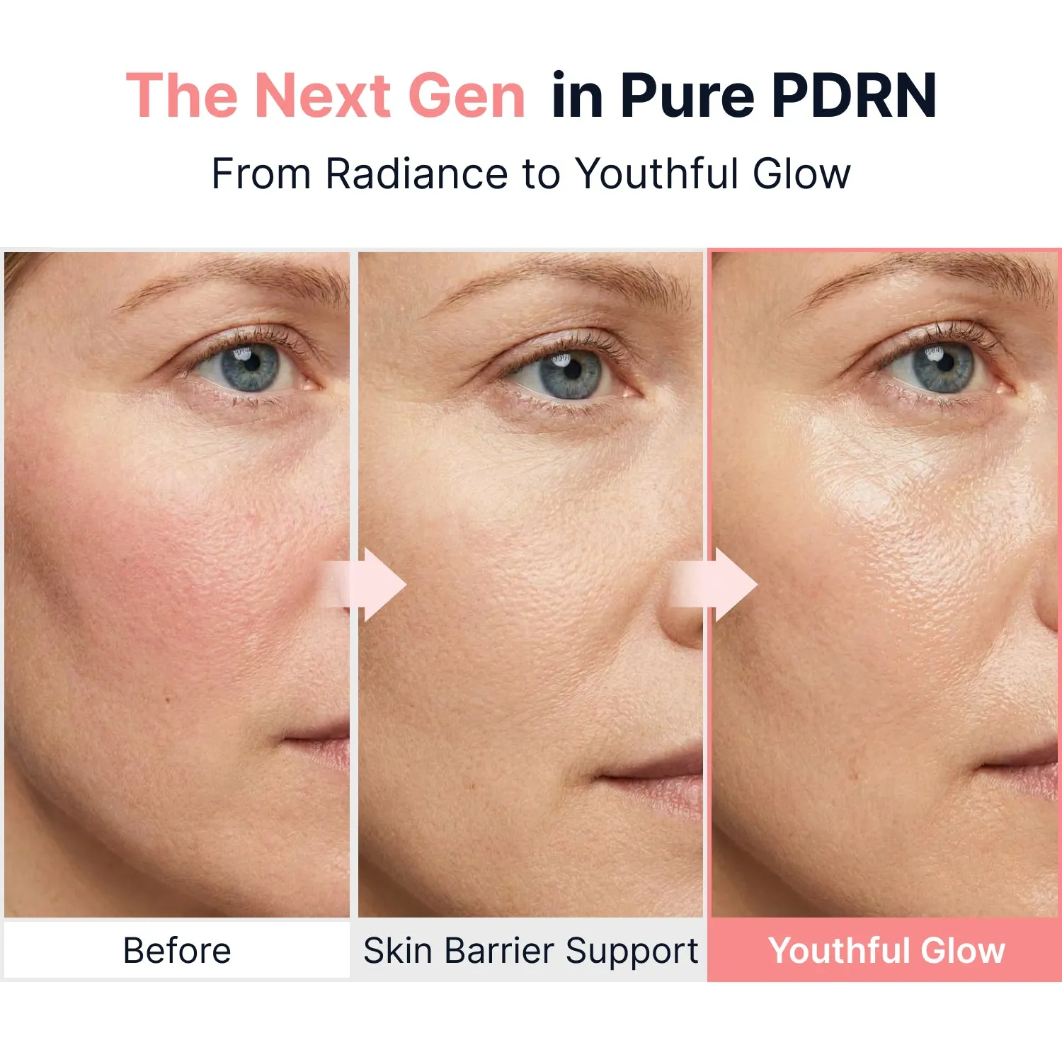 Sungboon Editor Collagen Peptide Pink PDRN ampolla viso 40 ml glow